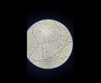 se