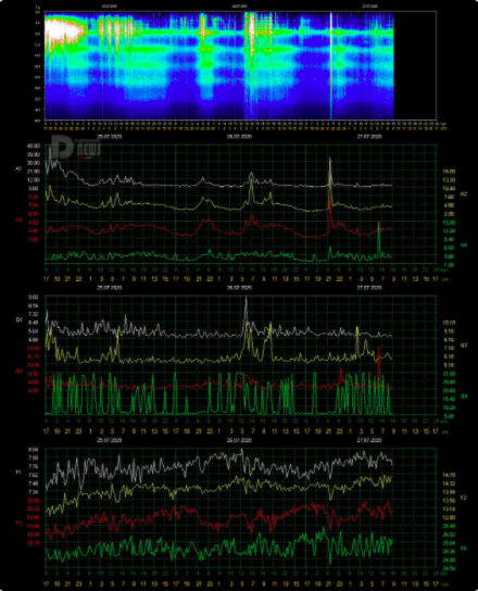 Captura de Tela 20200727 às 9.19.49 AM.png