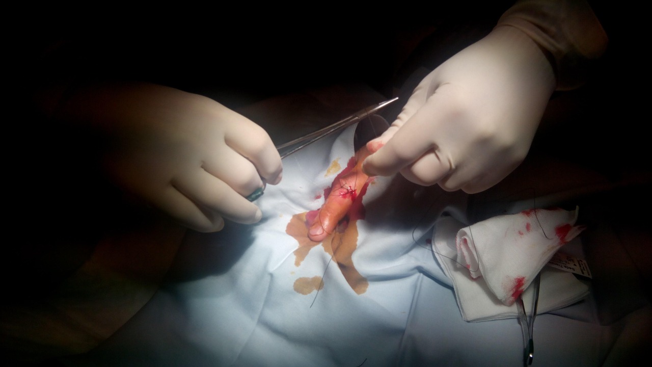 suture-259662_1280.jpg