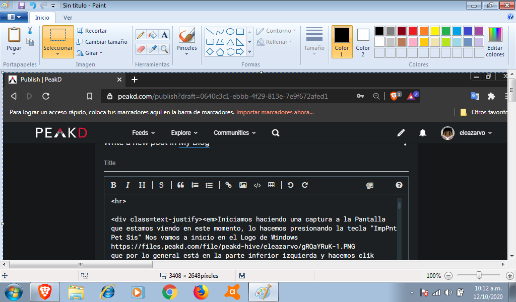 Xa3zHl78-image.png