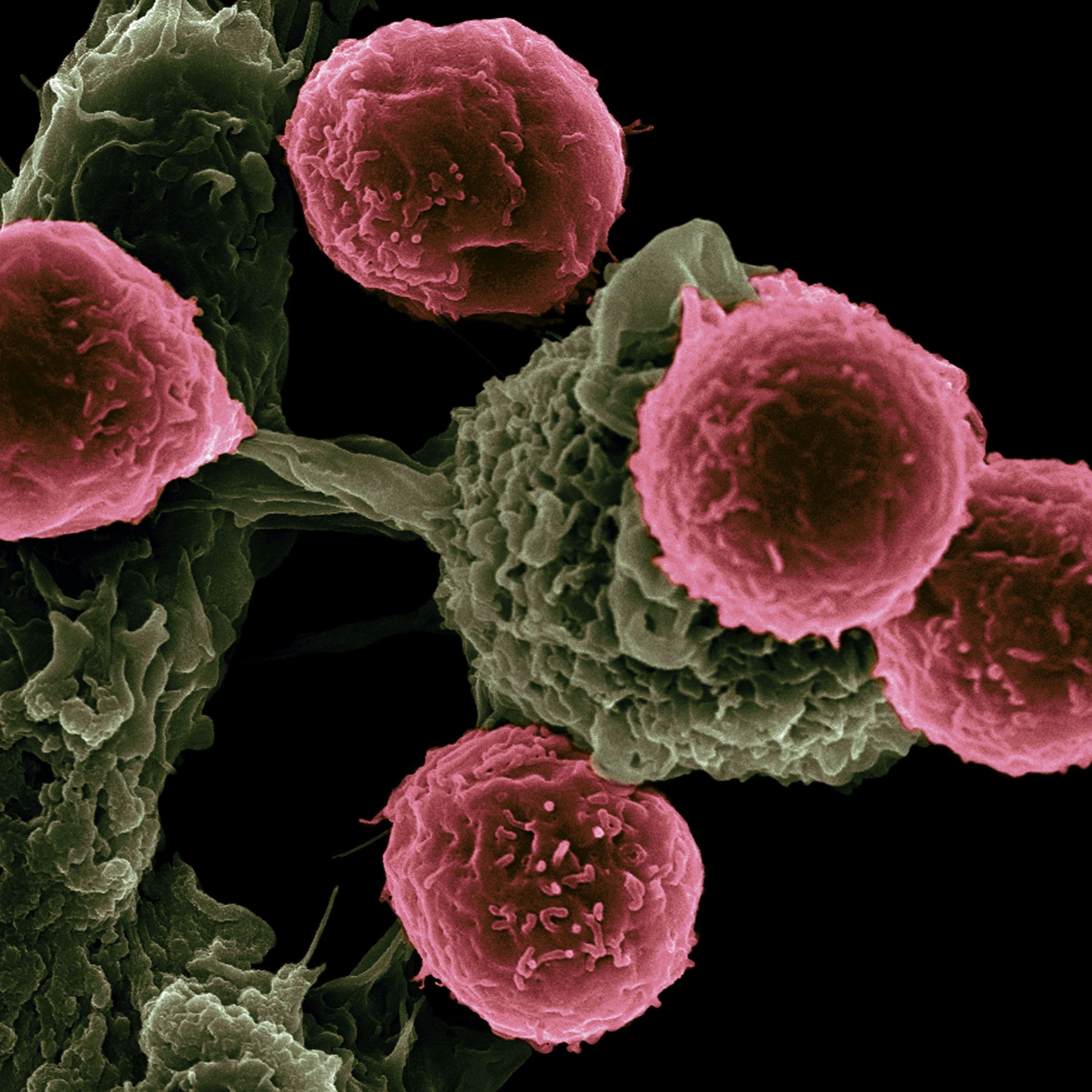 ingmar-cJ3qh…
Payout: 0.370 HBDA deadly disease
2025-08-11 09:37![national-cancer-institute-LnvCEXQwC-o-unsplash.jpg