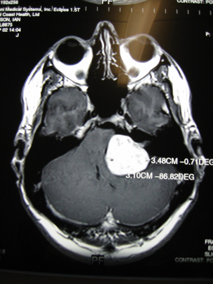 2002_09_MRI.Sheet09.Slice06.Copy_.jpg
