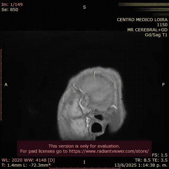 13-06-2025 Imagen RMN