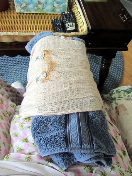 Cold pack on leg crop July 2025.jpg