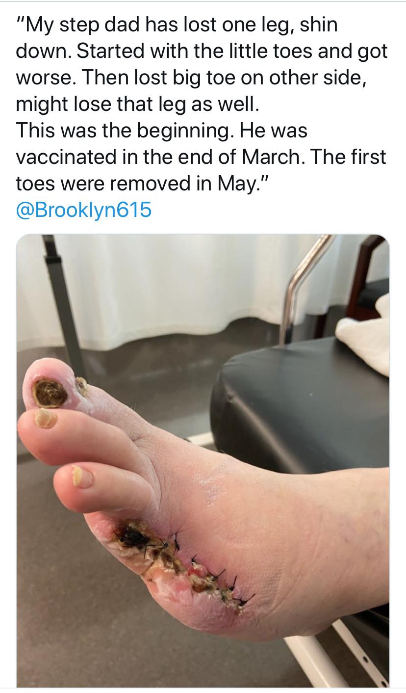 vax 86.jpg
