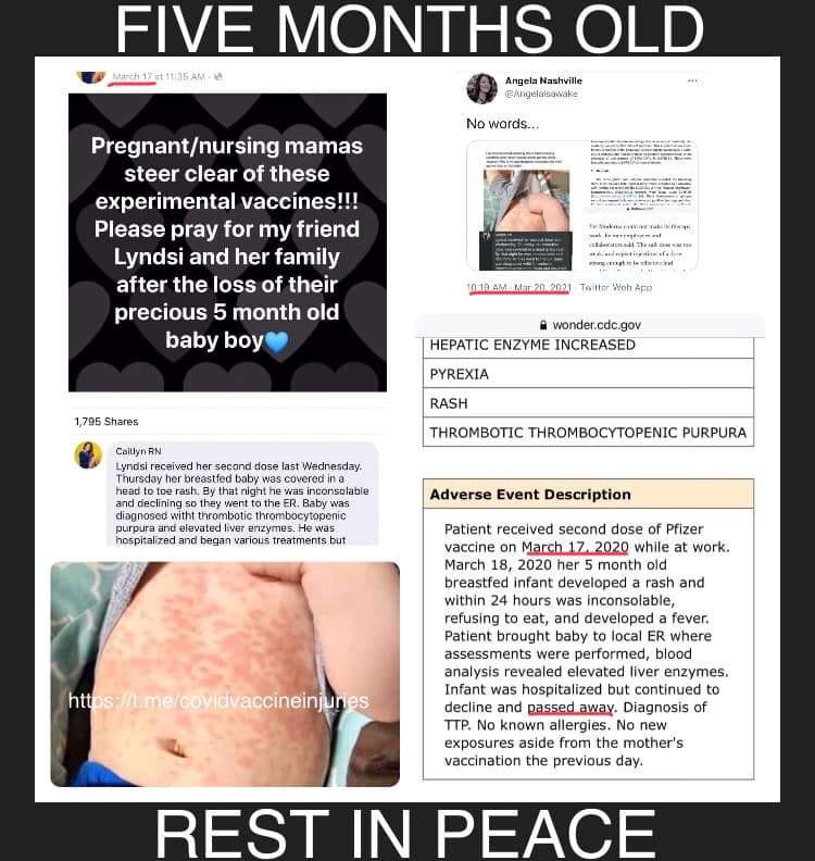 vax skin 17.jpg