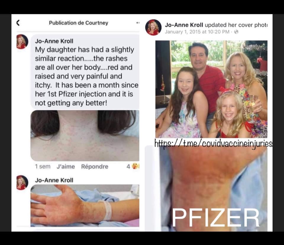 vax 23.jpg