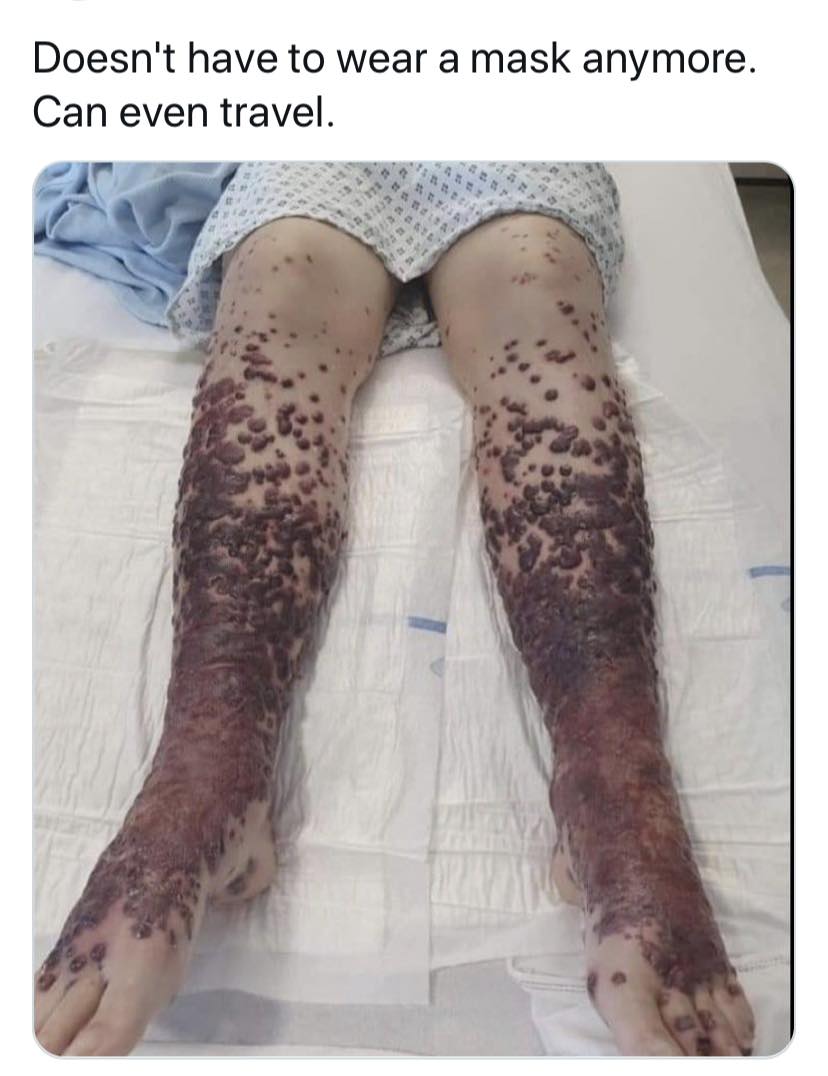 vax skin 13.jpg