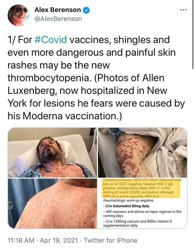vax skin 31.jpg
