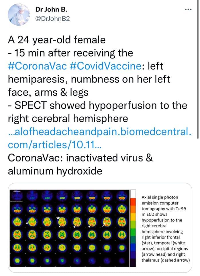 vax microscope 1.jpg