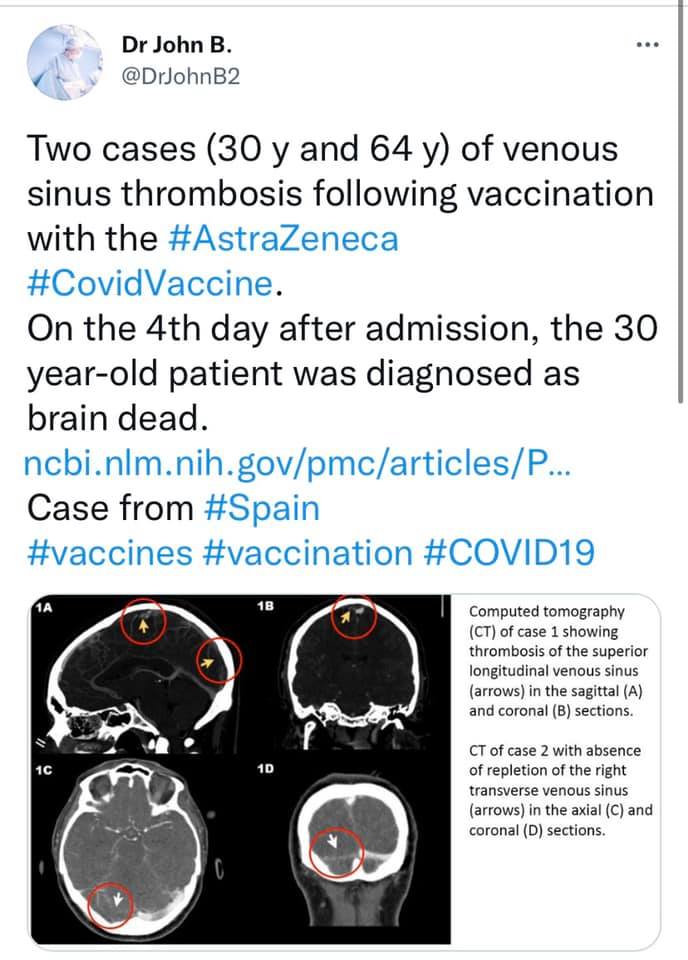vax microscope 3.jpg