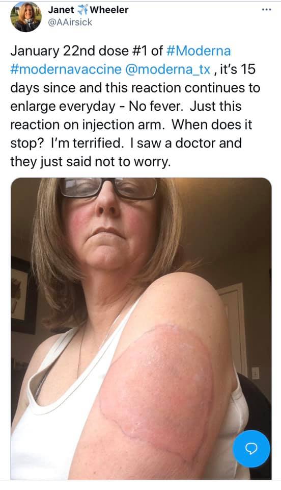 vax skin 34.jpg