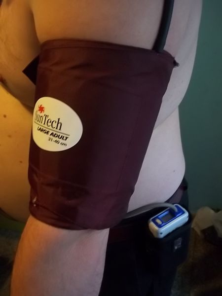 Monitoreo_ambulaorio_de_presion_arterial.jpg