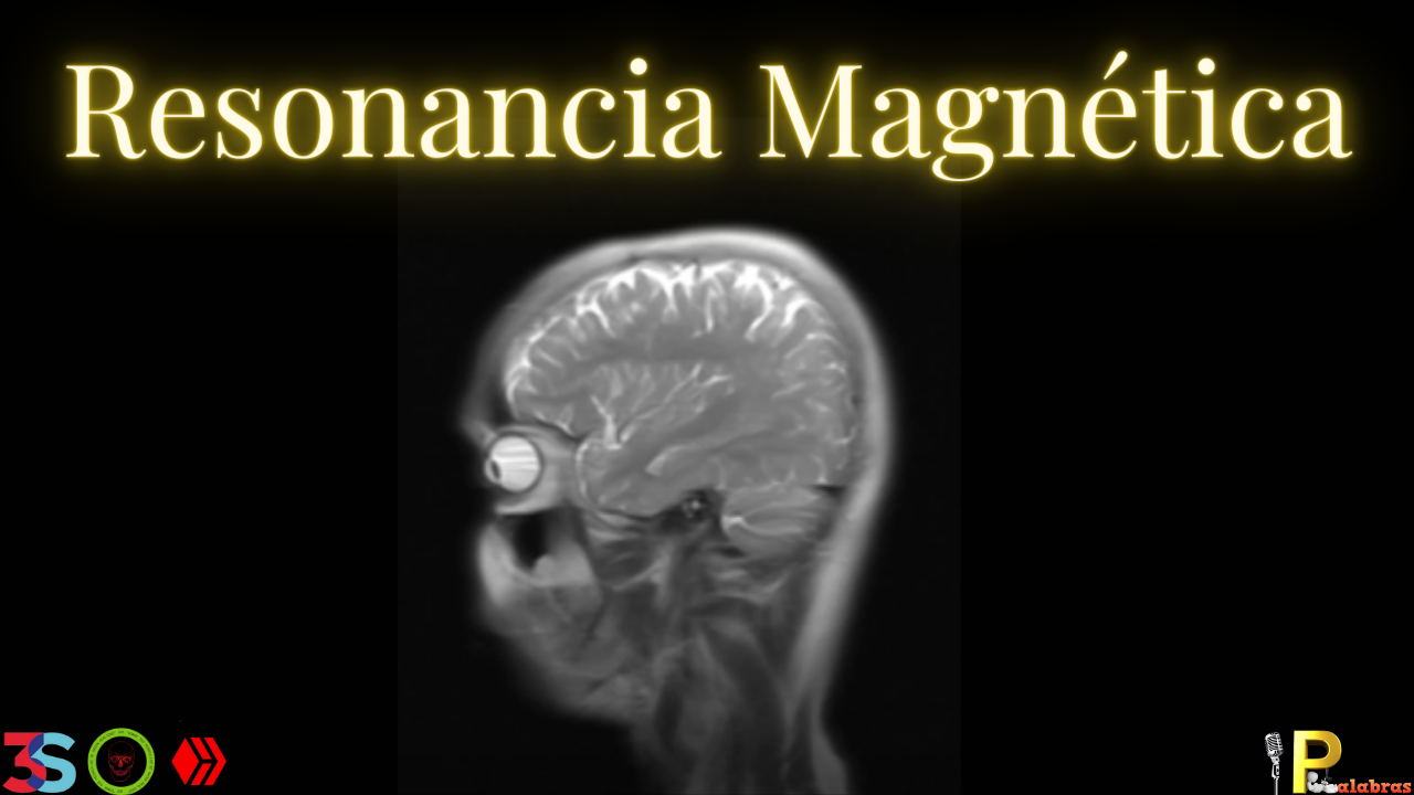 Resonancia Magnetica(1).png