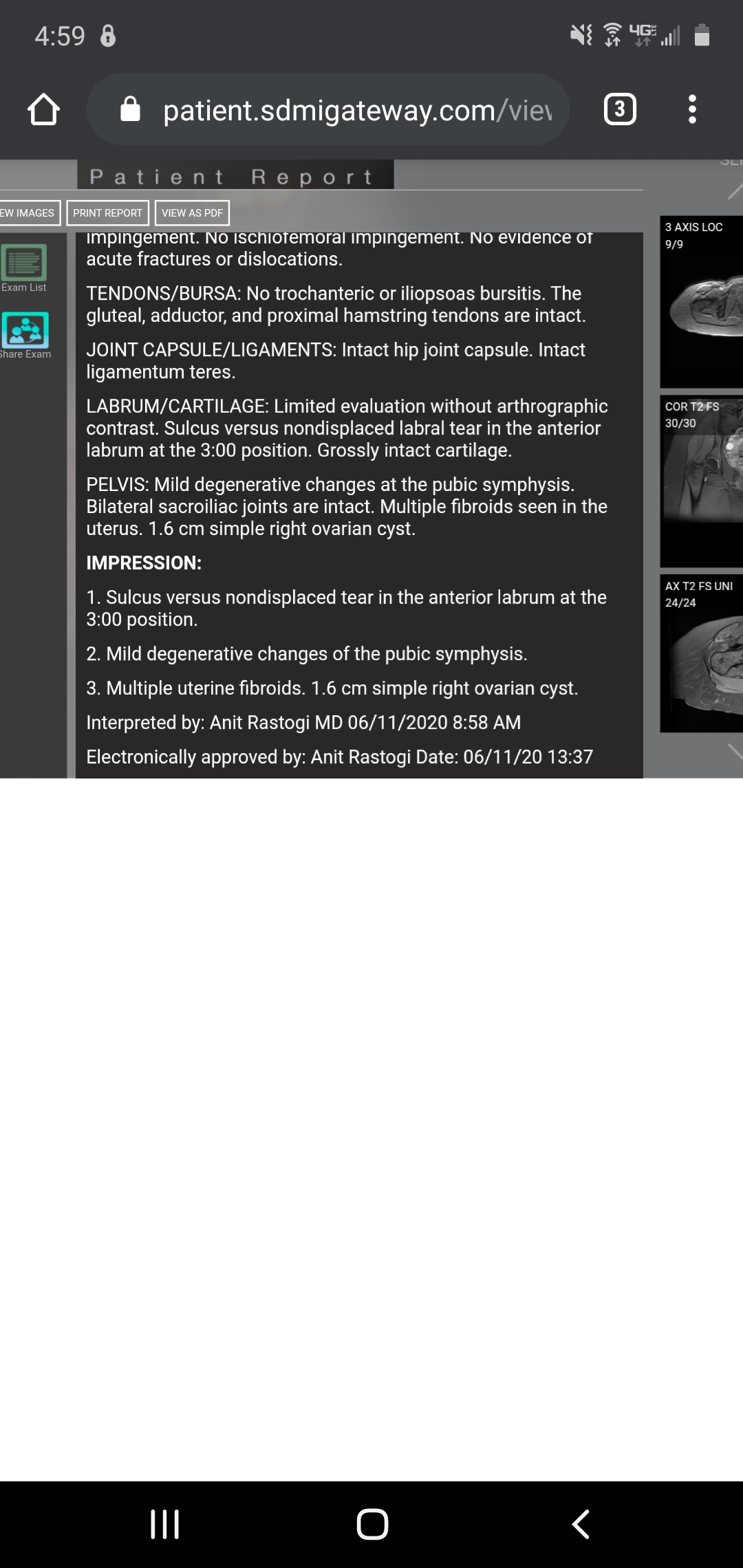 Pv18Vzlz-Screenshot_20200613-165946_Chrome.jpg