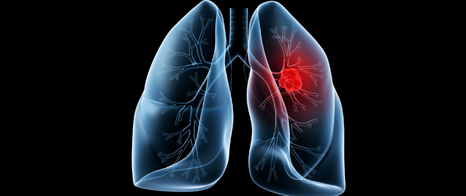 lung-950x400.png
