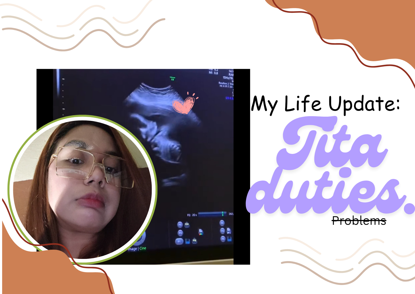 draclibthettykk…
Payout: 0.000 HBDDemo Teaching with Friends : A fun and Fruitful Experience
2025-02-27 12:58<div class="text-justify"> Hello,lovely hivers and readers! It's me again @geleniverse your future educator! welcome to my blog! Today I'm excited to share my experience in demo…
Payout: 0.000 HBDMy Life Update 🌱: Tita Duties 👶
2025-02-27 16:12![1000038932.png