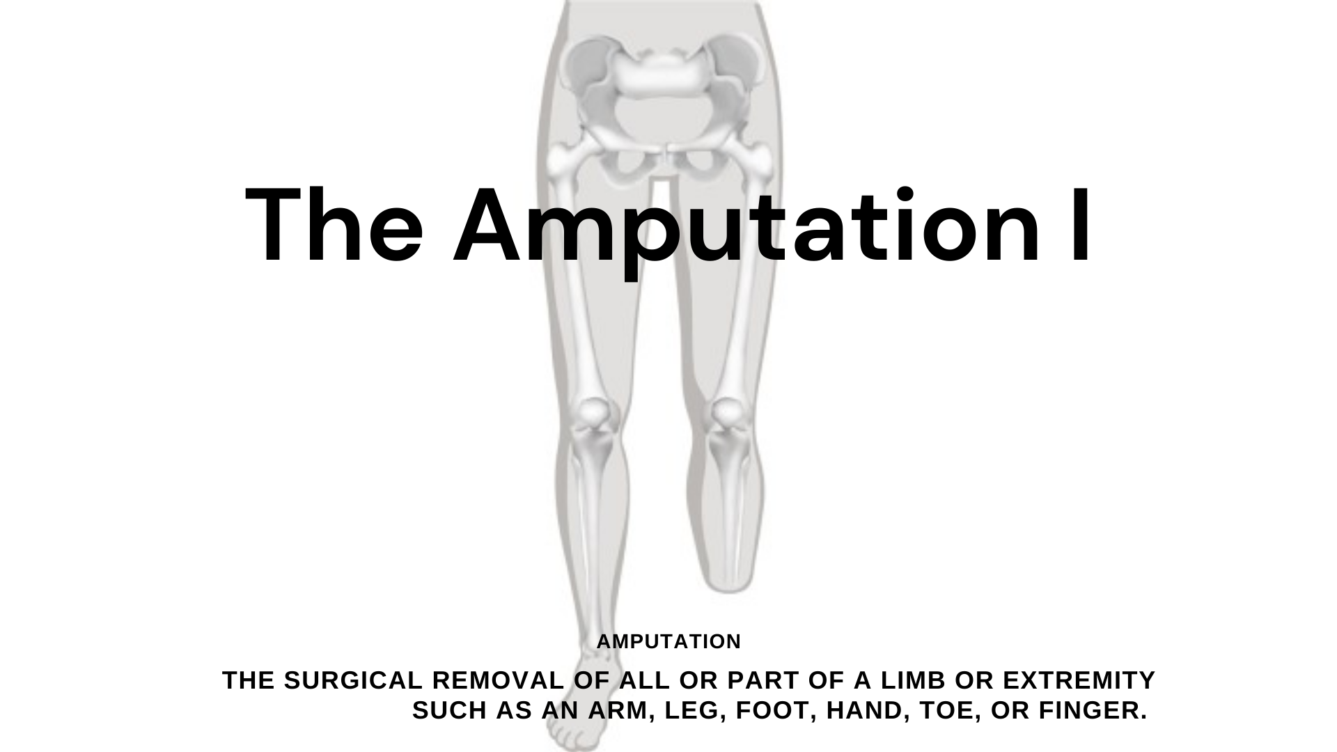 The Amputation I.png